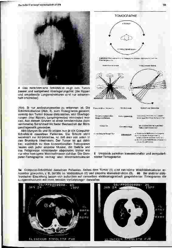 Vorschauseite 2: Medizin und Technik als Partner - Moderne Entwicklung in der medizinischen-technischen Diagnostik - Computer-Tomographie