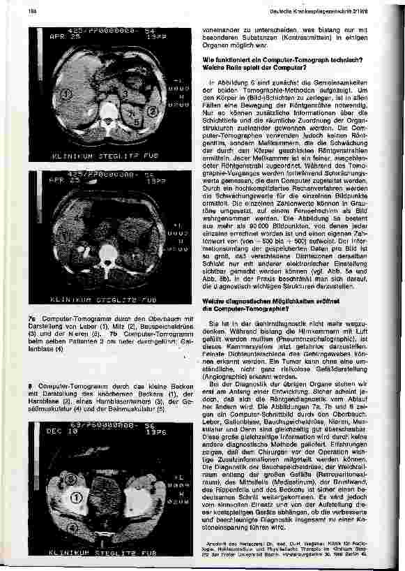 Vorschauseite 3: Medizin und Technik als Partner - Moderne Entwicklung in der medizinischen-technischen Diagnostik - Computer-Tomographie