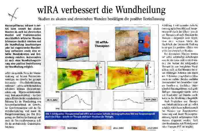 Vorschauseite 1: wIRA verbessert die Wundheilung