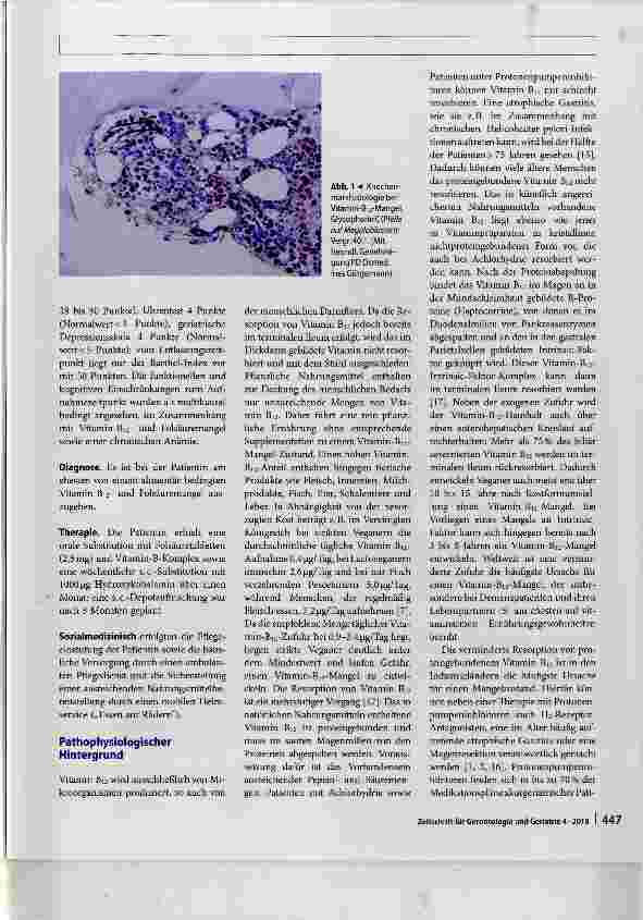 Vorschauseite 2: Klinisch-hämatologisches Bild des Vitamin-Bi2-Mangels im Alter