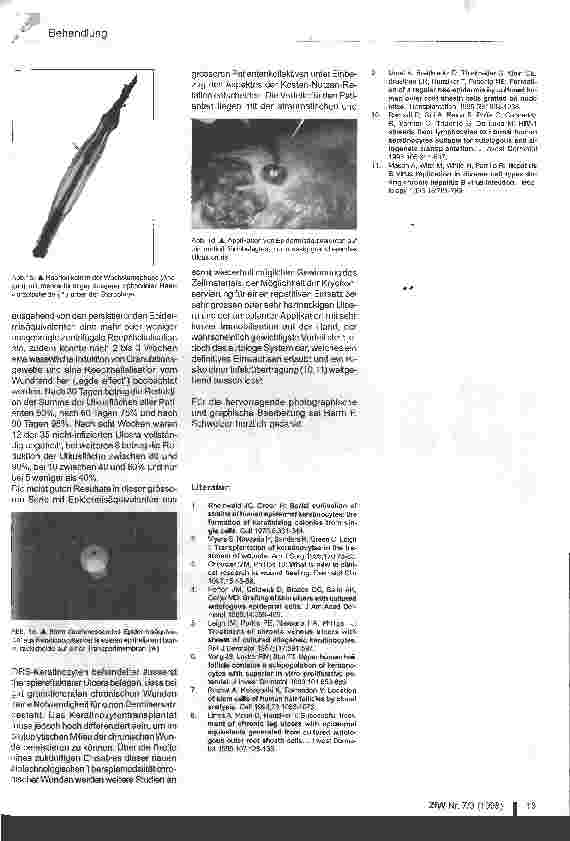 Vorschauseite 2: Behandlung therapierefraktärer chronischer Ulcera Cruris