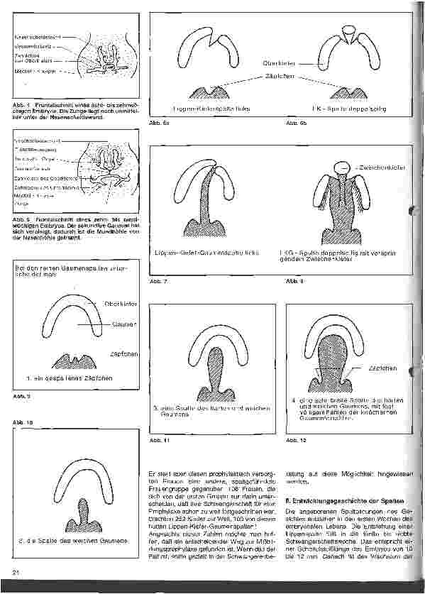 Vorschauseite 3: Kinder mit Lippen-Kiefer-Gaumenspalten Behandlung und Pflege 1. Folge: Allgemeine Pathologie