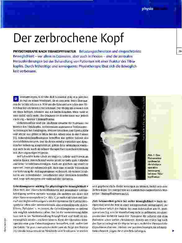 Vorschauseite 1: Der zerbrochene Kopf