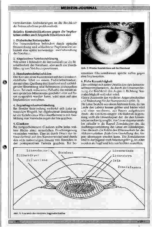 Vorschauseite 2: Klinik, Indikation und Ergebnisse der Intraocularlinsenimplantation