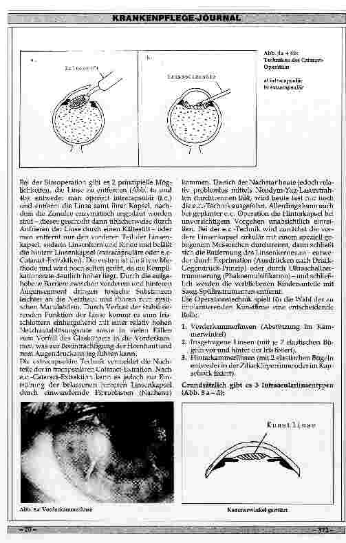 Vorschauseite 3: Klinik, Indikation und Ergebnisse der Intraocularlinsenimplantation