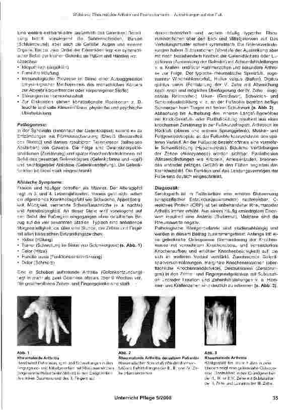 Vorschauseite 2: Rheumatoide Arthritis und Psoriasisarthritis Auswirkungen auf den Fuß