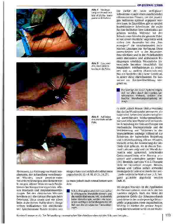 Vorschauseite 4: Die Behandlung traumatischer Weichteilwunden mit der Vakuumtherapie - Grundlagen, Indikationen und klinische Anwendung