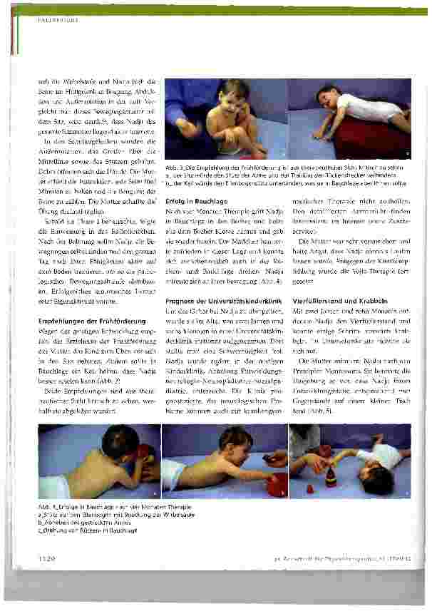 Vorschauseite 3: Physiotherapie bei neurologisch bedingten Bewegungsstörungen im Kindesalter