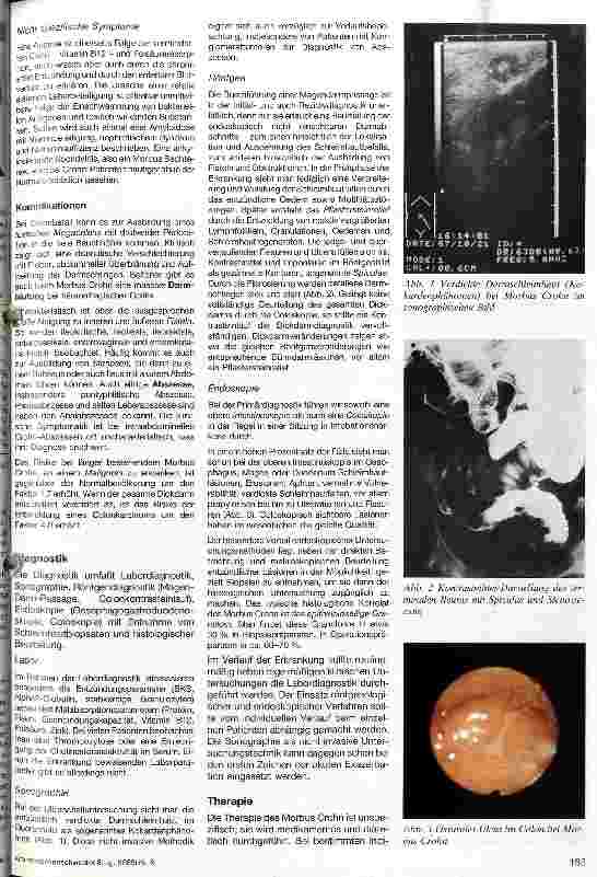 Vorschauseite 2: Morbus Crohn Ätiologie, klinisches Bild, Diagnostik, Therapie
