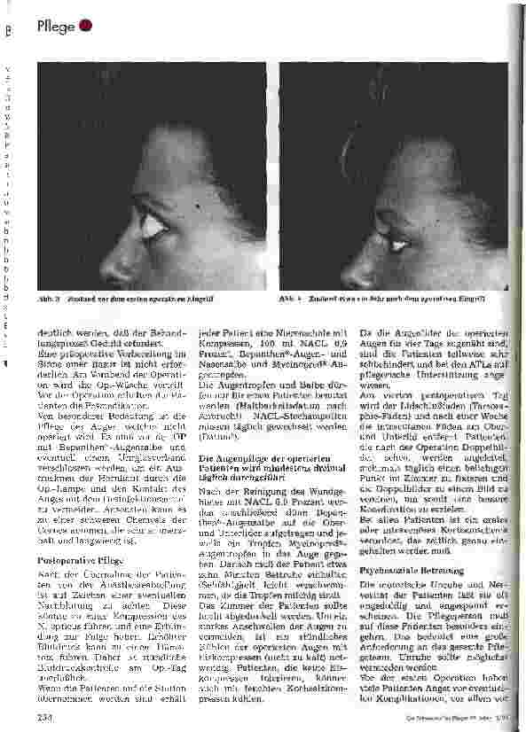 Vorschauseite 5: Die Endokrine Orbitopathie und ihre Behandlungsmöglichkeiten