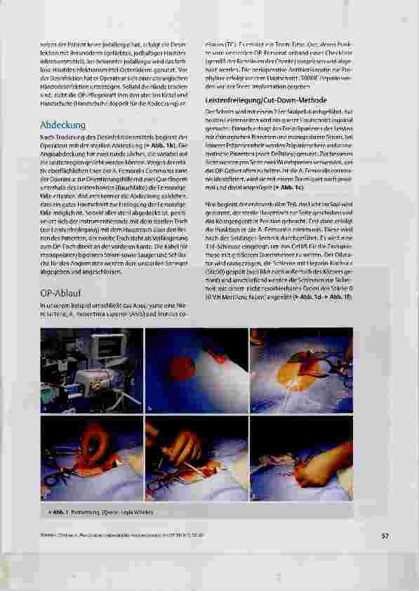 Vorschauseite 3: Fenestrierte endovaskuläre Aortenreparatur