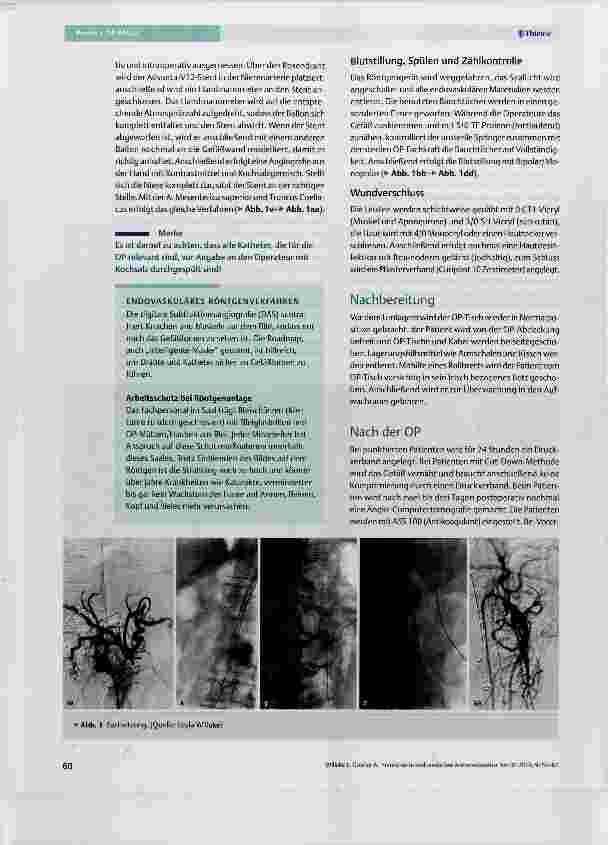 Vorschauseite 6: Fenestrierte endovaskuläre Aortenreparatur