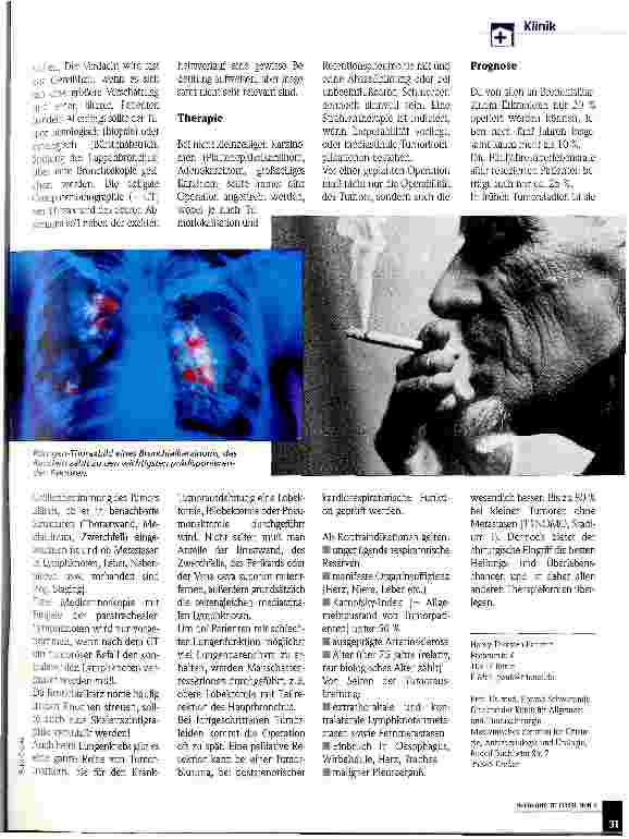 Vorschauseite 2: Das Bronchialkarzinom