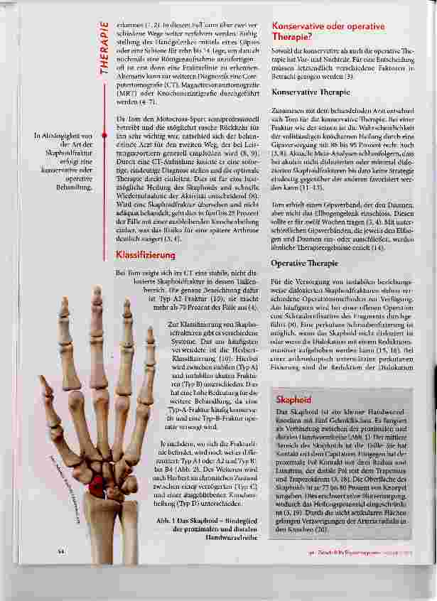 Vorschauseite 2: Skaphoidfraktur