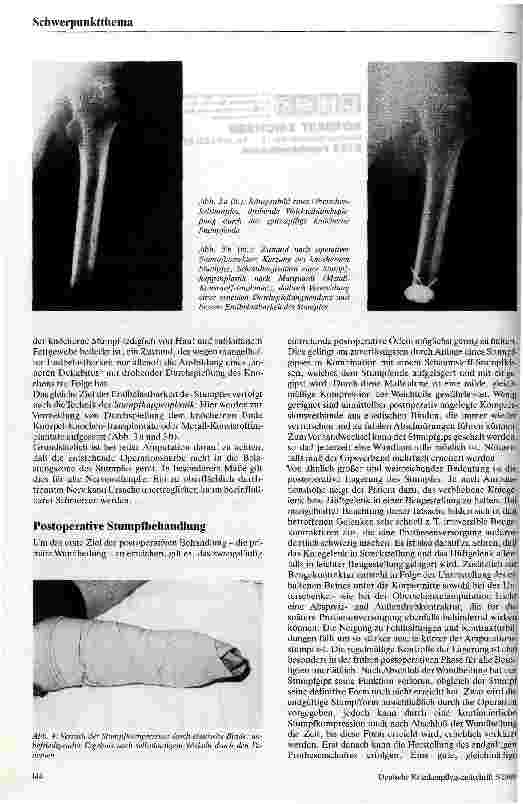 Vorschauseite 3: Grundprinzipien der Amputationschirurgie Operative Strategie, postoperative Behandlung und Prothesenversorgung