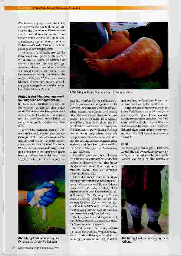 Vorschauseite 2: Ohnmacht oder Konzept Der adipöse Wundpatient