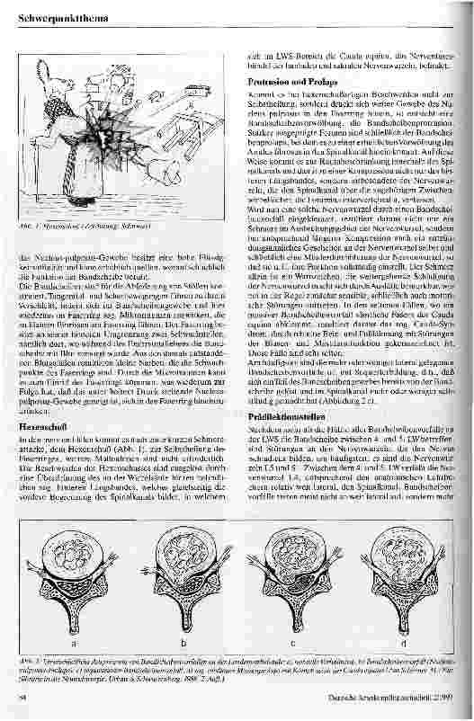 Vorschauseite 2: Bandscheibenvorfälle an der Lendenwirbelsäule