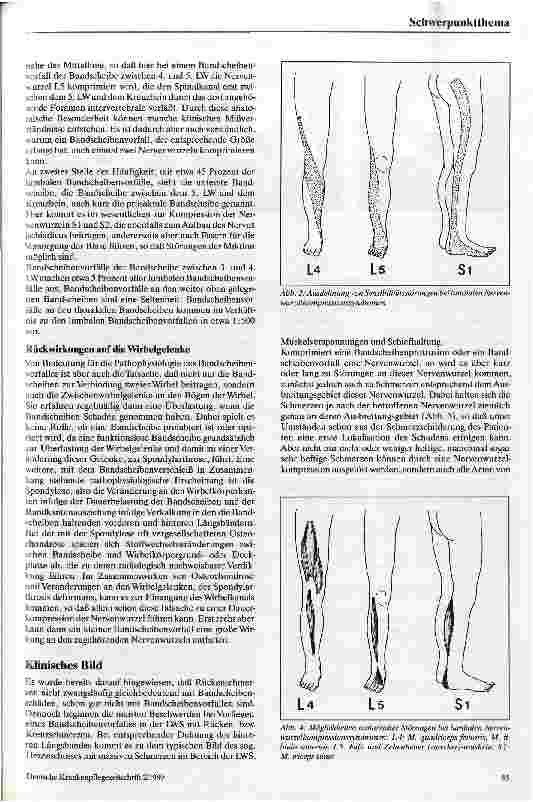 Vorschauseite 3: Bandscheibenvorfälle an der Lendenwirbelsäule