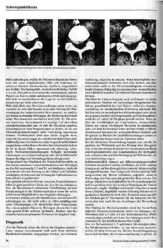 Vorschauseite 4: Bandscheibenvorfälle an der Lendenwirbelsäule