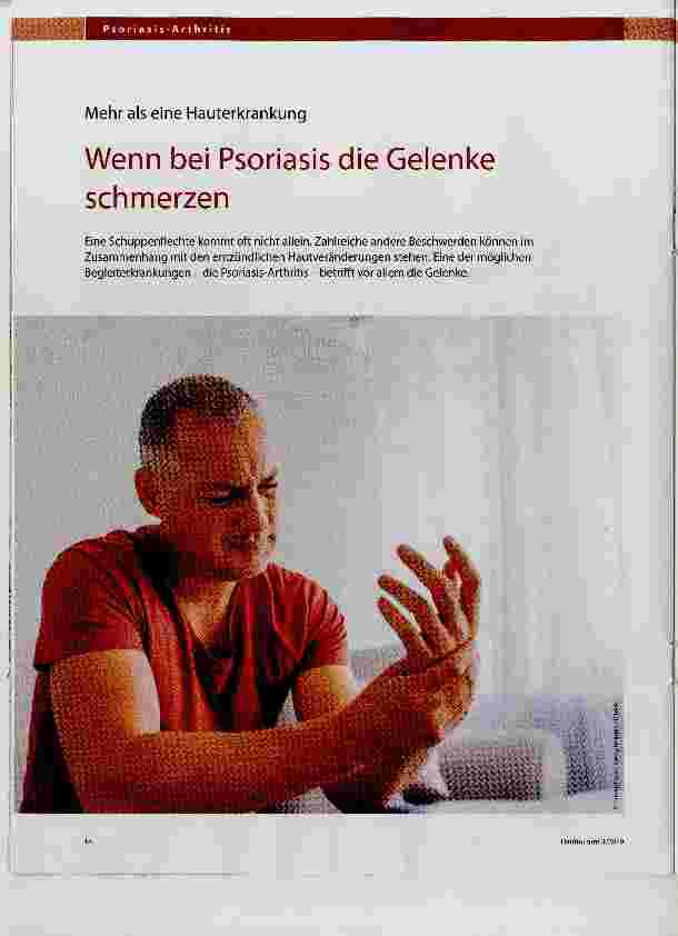 Vorschauseite 1: Wenn bei Psoriasis die Gelenke schmerzen