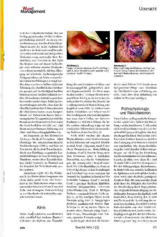 Vorschauseite 2: Wundbehandlung während der perkutanen Strahlentherapie