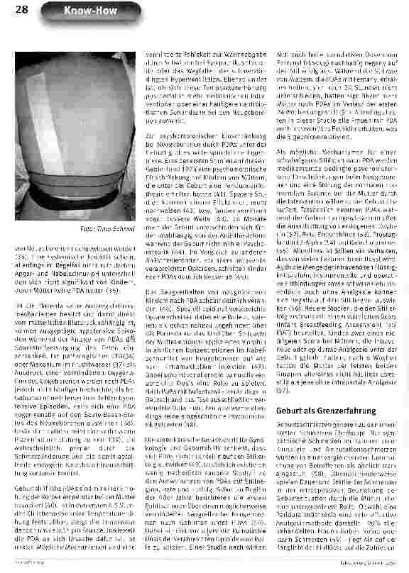 Vorschauseite 3: Periduralanästhesie für alle?