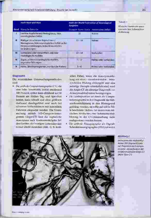 Vorschauseite 2: Aneurysmaclipping nach Subarachnoidalblutung Braucht man das noch?