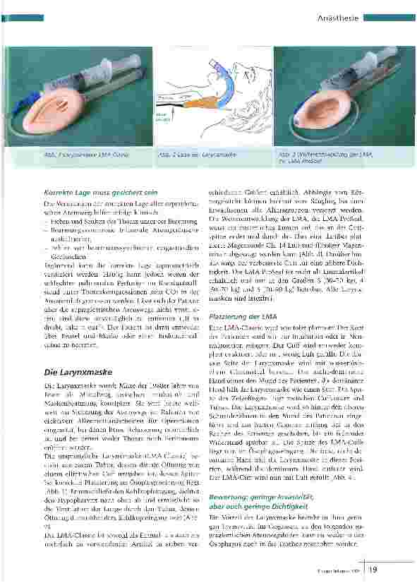 Vorschauseite 2: Alternative zur Intubation
