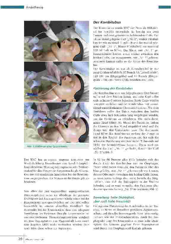 Vorschauseite 3: Alternative zur Intubation