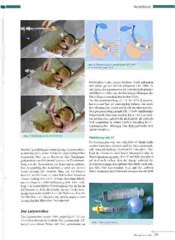 Vorschauseite 4: Alternative zur Intubation