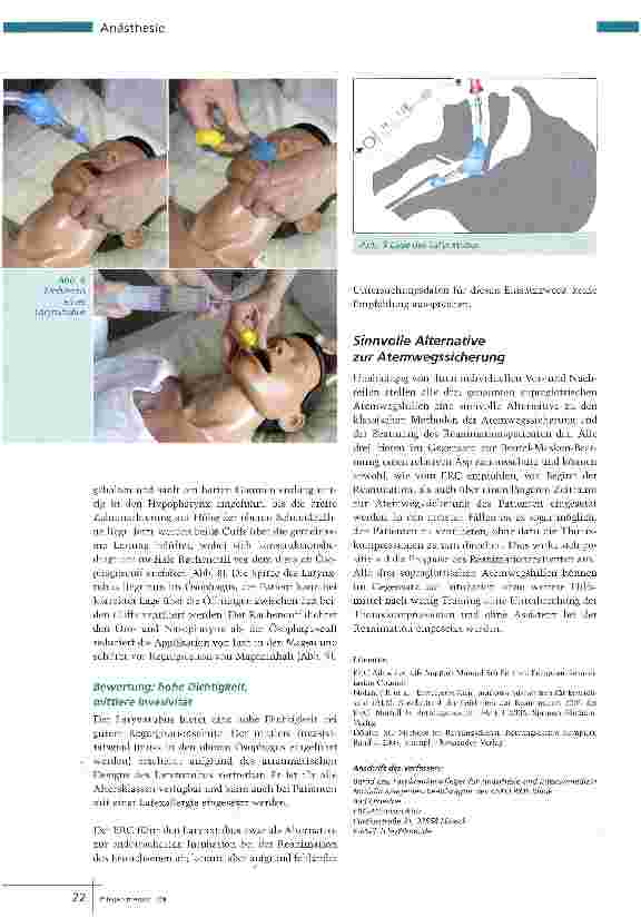 Vorschauseite 5: Alternative zur Intubation