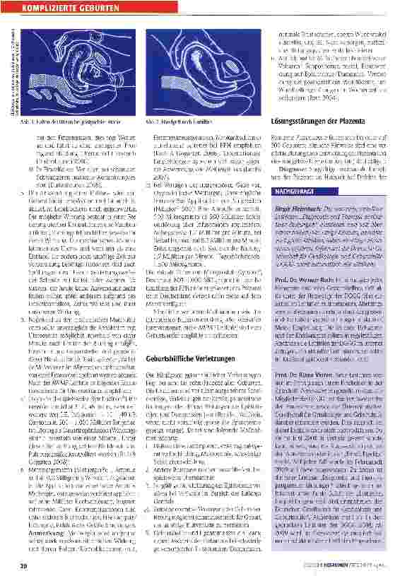 Vorschauseite 3: Periund postpartale Blutungen -die neue Leitlinie