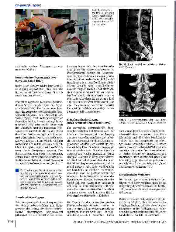 Vorschauseite 3: Operative Behandlung des lumbalen Bandscheibenvorfalls