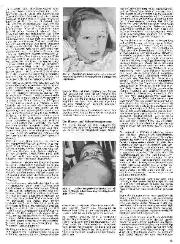 Vorschauseite 2: Kinderheilkunde 11. Folge: Tumorkrankheiten im Kindesalter