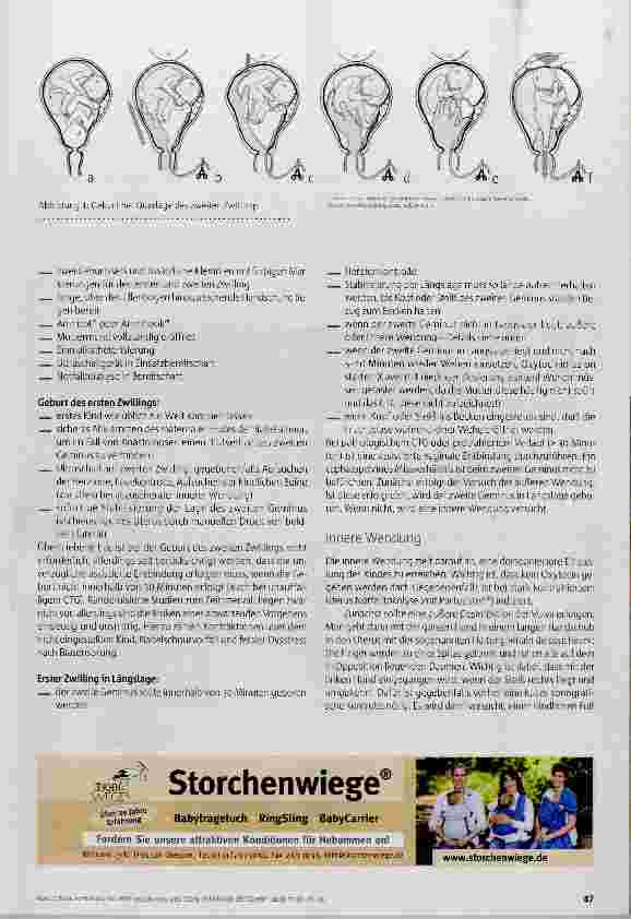 Vorschauseite 2: Manövertraining für Zwiilingsgeburten