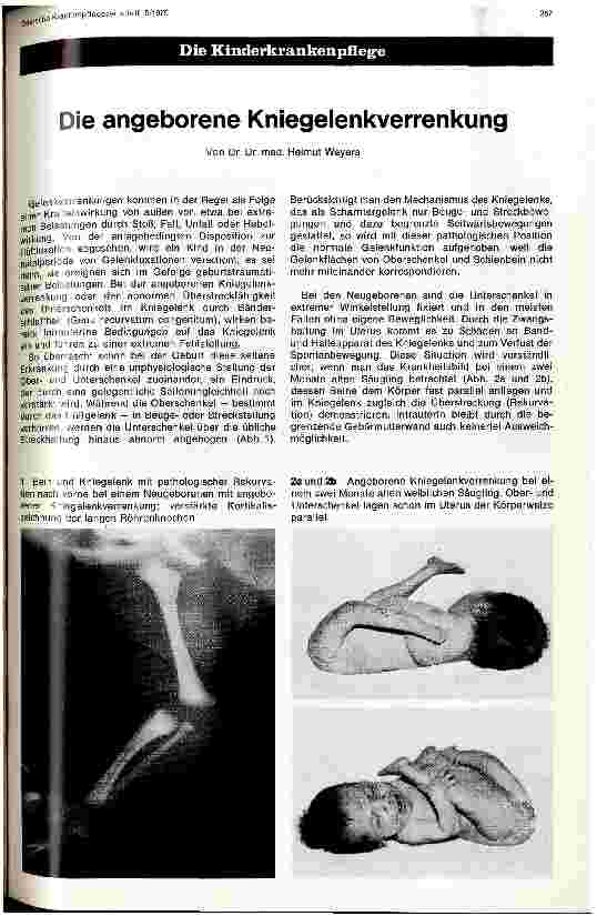 Vorschauseite 1: Die angeborene Kniegelenkverrenkung