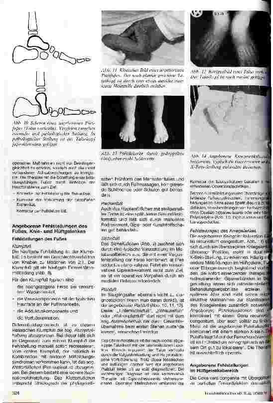 Vorschauseite 3: Angeborene Fehlstellungen und Fehlbildungen an der unteren Extremität