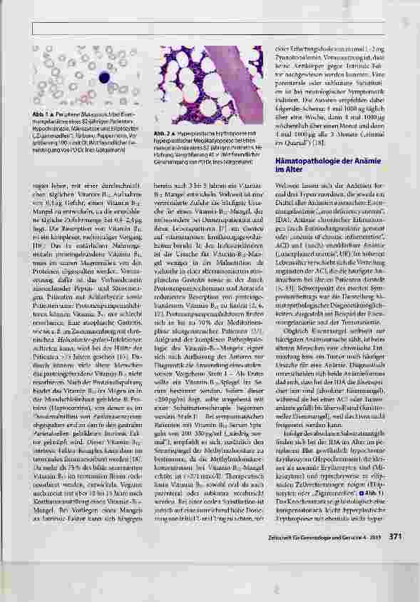Vorschauseite 2: Anämie als geriatrisches Syndrom Zusammenfassung des Symposiums der AG Anämie anlässlich der Jahrestagung der Deutschen Gesellschaft für Geriatrie 2018 in Köln