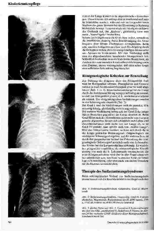 Vorschauseite 2: Surfactantmangel Das Atemnotsyndrom des Frühgeborenen
