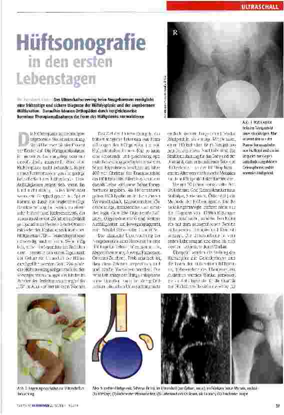 Vorschauseite 1: Hüftsonografie in den ersten Lebenstagen