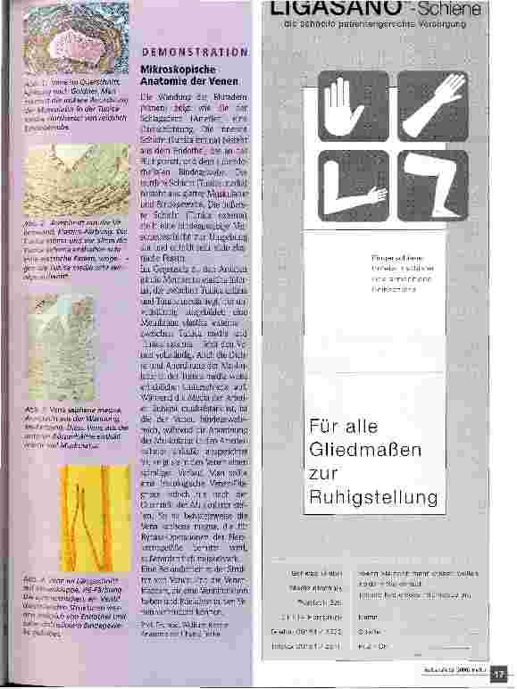 Vorschauseite 2: Patienten mit Varicosis