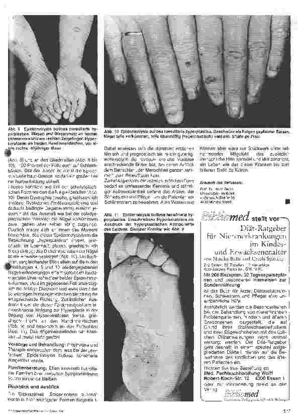 Vorschauseite 3: Hautärztliche Blick-Diagnose von Erbkrankheiten: Epidermolysis bullosa hereditaria