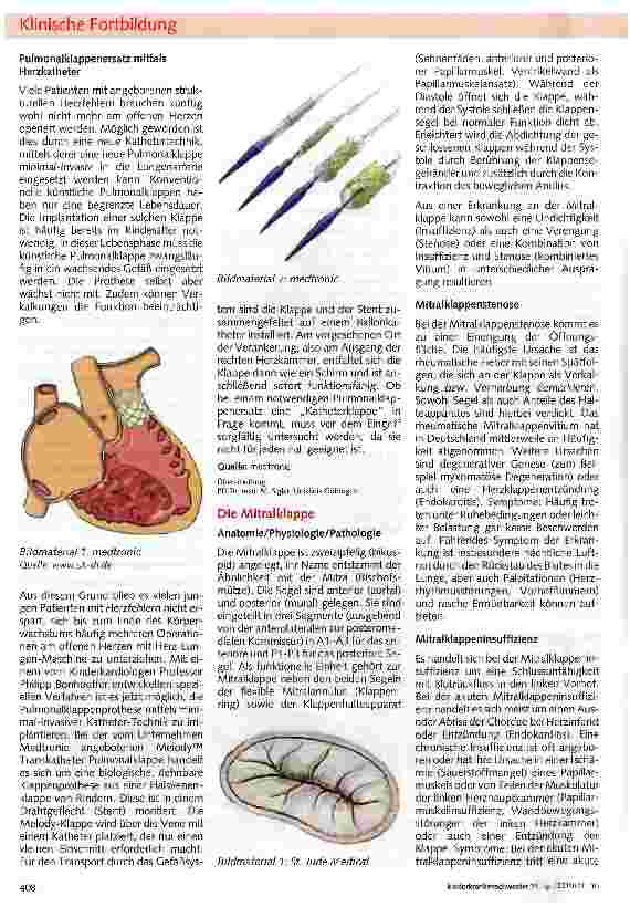 Vorschauseite 3: Die Herzklappen