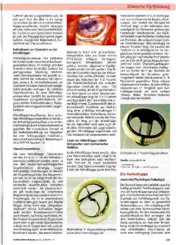 Vorschauseite 4: Die Herzklappen