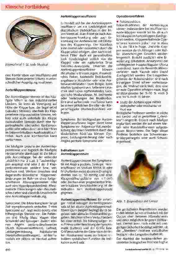 Vorschauseite 5: Die Herzklappen