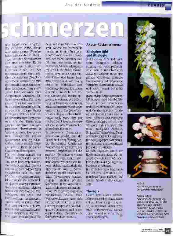 Vorschauseite 2: Rückenschmerzen