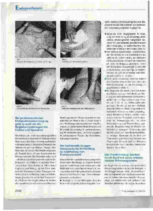 Vorschauseite 3: Brüggertherapeutische Behandlung nach dem Einsatz von Knieund Hüftendoprothesen