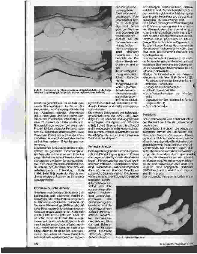 Vorschauseite 3: Der Patient mit chronischer Polyarthritis 1. Folge: Polyarthritis, die rheumatische Erkrankung