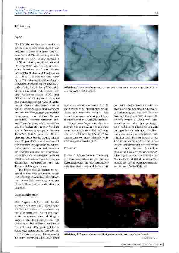 Vorschauseite 2: Protein C in der Pädiatrischen Intensivmedizin