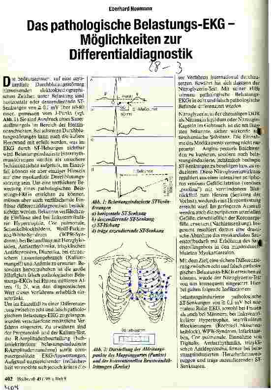 Vorschauseite 1: Das pathologische Belastungs-EKG - Möglichkeiten zur Differentialdiagnostik